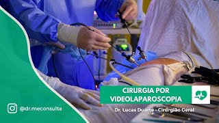 Cirurgia por videolaparoscopia Como funciona [upl. by Mongeau]