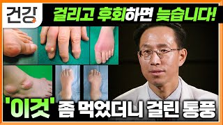 절대 완치 불가 통풍 관리하지 않으면 사망하기도 한다│걸리고 후회하기 전에 반드시 알아야 하는 통풍 관리법│명의│EBS건강 [upl. by Lukey]