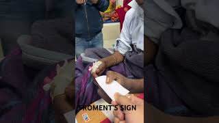 Froment’s Sign Book Test for Ulnar Nerve Palsy [upl. by Ativla]