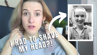 A Doctor Made Me SHAVE MY HEAD for No Reason 👨🏻‍🦲  Storytime Saturday [upl. by Ariayek]