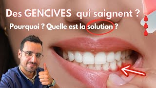 Explication GENCIVE qui SAIGNE  la solution [upl. by Ailhad]