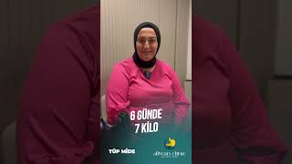 Tüp Mide İle 6 Günde 7 Kilo Verdi [upl. by Karlan]