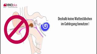 Ohrenschmalz  5 häufige Fragen aus der HNO Praxis [upl. by Suhploda]