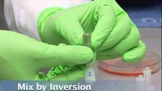 3 White Cell Count Loading Hemocytometer [upl. by Rosse]