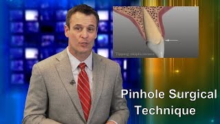 Pinhole Surgical Technique for Gum Recession Dr Nemeth Explains 2018 [upl. by Ingamar628]