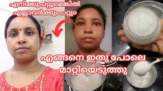 കറുത്ത മുഖവു൦ കരിമ൦ഗലൃവു൦ മാറ്റിയത് ഇങ്ങനെയാണ്how to make pigmentation face pack തെളിവ് സഹിത൦ [upl. by Charin]