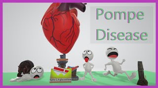 Pompe Disease Mnemonic for the USMLE [upl. by Oisorbma59]