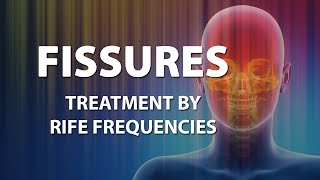 Fissures  RIFE Frequencies Treatment  Energy amp Quantum Medicine with Bioresonance [upl. by Ainoloppa]