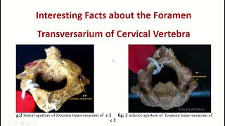 Interesting facts about the foramen transversarium of cervical vertebra [upl. by Davina]