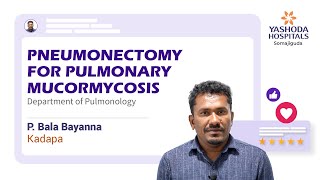 Pneumonectomy for Pulmonary Mucormycosis  Black Fungus Infection  Yashoda Hospitals [upl. by Ehudd]