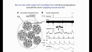 Webinar – Microneurography Recording Nerve Traffic Via Intraneural Microelectrodes [upl. by Ssilem]