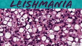 Leishmaniasis 5Minute Pathology Pearls [upl. by Catlin701]