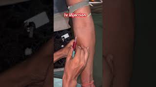 Iv injection viralvideo li [upl. by Netsryk]