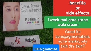 Medisalic Cream Review गोरा होने का सबसे अच्छा क्रीम इस cream के फायदे और नुकसान दोनों जान लें [upl. by Zeeba]