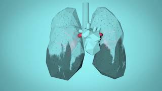 WHO Breathe Life  How air pollution impacts your body [upl. by Mirella138]