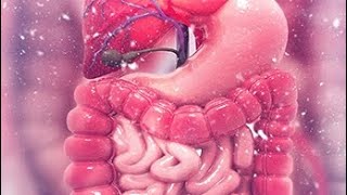 Intestinal obstruction part 2 and Benign tumor of intestine [upl. by Nordek884]