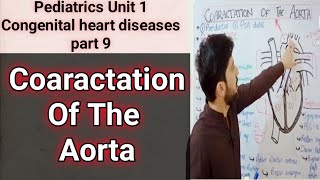 coarctation of the aorta  pre ductal and post ductal  pathophysiology symptoms and treatment [upl. by Jareen]