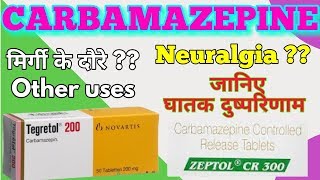 Carbamazepine  Tegretol  Carbamazepine tablets  Tegretol 200 mg  carbamazepine side effect [upl. by Fabien]