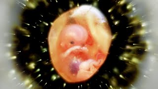 Foetus and Womb Protection Baby Healing Frequency [upl. by Ostraw]