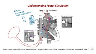 Preductal pulse oximetry  why does the probe always go on a newborns right hand [upl. by Obelia]