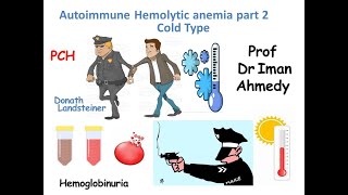 Autoimmune Hemolytic Anemia part 2 cold type [upl. by Bertle]