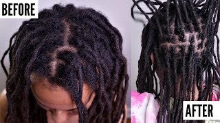 ALL About INTERLOCKING Locs  Does It Cause THINNING  Dreadlock QampA [upl. by Ynavoj]