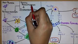 What is rheumatoid arthritis Part 1  Introduction Etiology Pathogenesis [upl. by Keese]