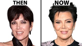 Kris Jenners NEW FACE  Plastic Surgery Analysis [upl. by Inkster]