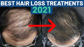 Best Hair Loss Treatments RANKED Fin Min PRP [upl. by Thrasher]