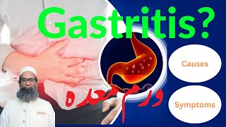 What is Gastritis Causes and Symptoms  Urdu  Hindi  Shahbaz Qamar [upl. by Cassius]