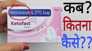 Ketoconazole Soap  Keto Soap benefits in Hindi  कीटो सोप के फायदे  Keto Soap uses [upl. by Eiramlatsyrk]