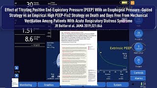 PEEP Tritration durch Bestimmung transpulmonaler Druckgradient mittels ösophagealer Manometrie bei [upl. by Akilaz]