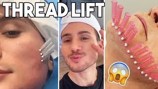 I got a Bella Hadid Face Thread Lift with 60 Threads😱  Fox Eyes Brow Lift [upl. by Ateuqal]