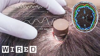 The Science Behind Elon Musk’s Neuralink Brain Chip  WIRED [upl. by Domenech18]