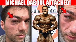 🚨MICHAEL DABOUL ATTACK NEW DETAILS  Palumbo amp Aceto  HMR 4724 [upl. by Vincenty]