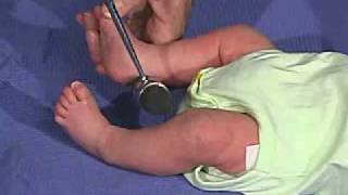 physical exam Newborn NormalReflexesDeep Tendon Reflexes [upl. by Hallsy88]