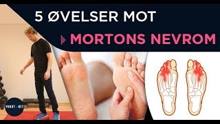 5 øvelser mot mortons nevrom nerveavklemming mellom tærne [upl. by Eelytsirk79]