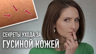 УХОД ЗА ТЕЛОМ ДОМА  Схема ухода при фолликулярном кератозе и любимые средства [upl. by Ellednahc743]