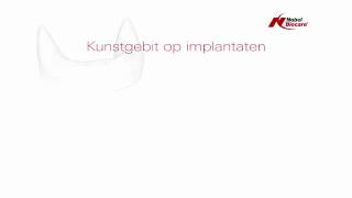 Kunstgebit op implantaten [upl. by Rillings651]