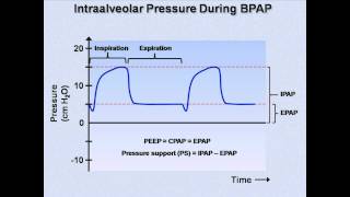 NonInvasive Positive Pressure Ventilation Mechanical Ventilation  Lecture 6 [upl. by Ruff]