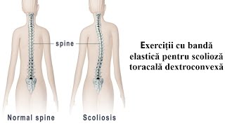 6 Exercitii pentru Scolioza Toracala Dreapta [upl. by Punak178]