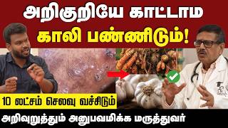 Fatty Liver  கல்லீரல் பற்றி யாருக்கும் தெரியாத அதிர்ச்சி தகவல்ககள் 😱  Liver  Positivitea [upl. by Toddy]