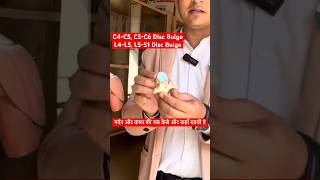 C4C5 C5C6 amp L4L5 L5S1 Disc Bulge  गर्दन और कमर की नस कैसे ओर कहाँ दबती है । Cervical Problem [upl. by Derr600]