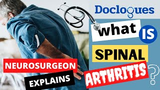 What is Spinal Arthritis [upl. by Sudderth]