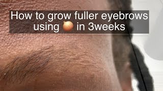 How To Grow Thicker Eyebrows Naturally and Faster [upl. by Direj]