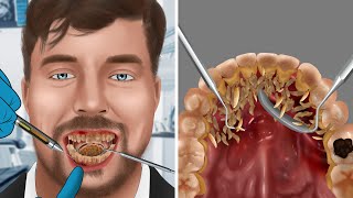 ASMR Treat cavities remove tartar and clean inflamed gums  WOW Brain Satisfyingvideo [upl. by Player]