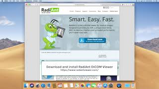 RadiAnt DICOM Viewer on macOS Mojave [upl. by Ewold]