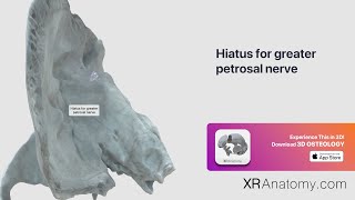 Temporal Bone  Hiatus for greater petrosal nerve [upl. by Killoran]