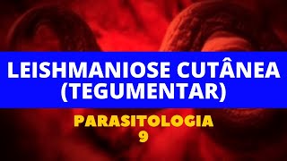 LEISHMANIOSE CUTÂNEA TEGUMENTAR  PARASITOLOGIA 9 [upl. by Aneekan]