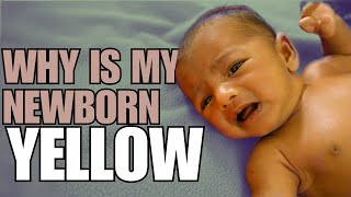 Newborn Jaundice Causes Symptoms and Treatment [upl. by Casey]